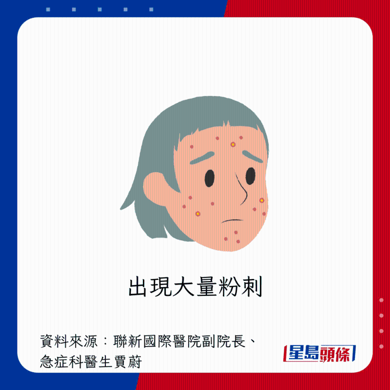 肝臟過勞警號:出現大量粉刺