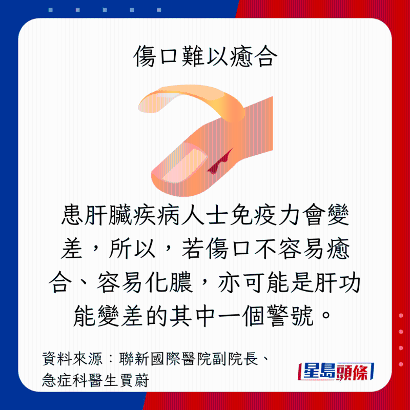 肝臟過勞警號:傷口難以癒合