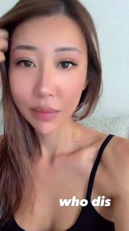 陈婉衡早前晒出自拍,惊见她变超V面及厚唇样。 陈婉衡早前晒出自拍,惊见她变超V面及厚唇样。