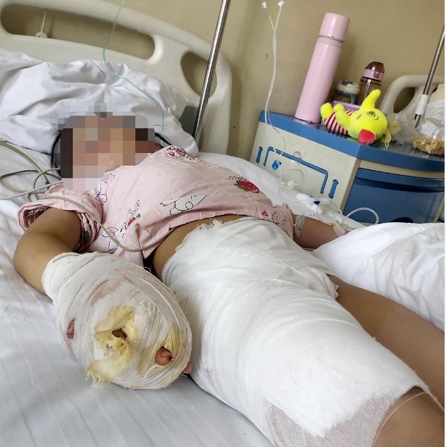 冷血继母虐待7岁妹致残 冷血继母虐待7岁妹致残