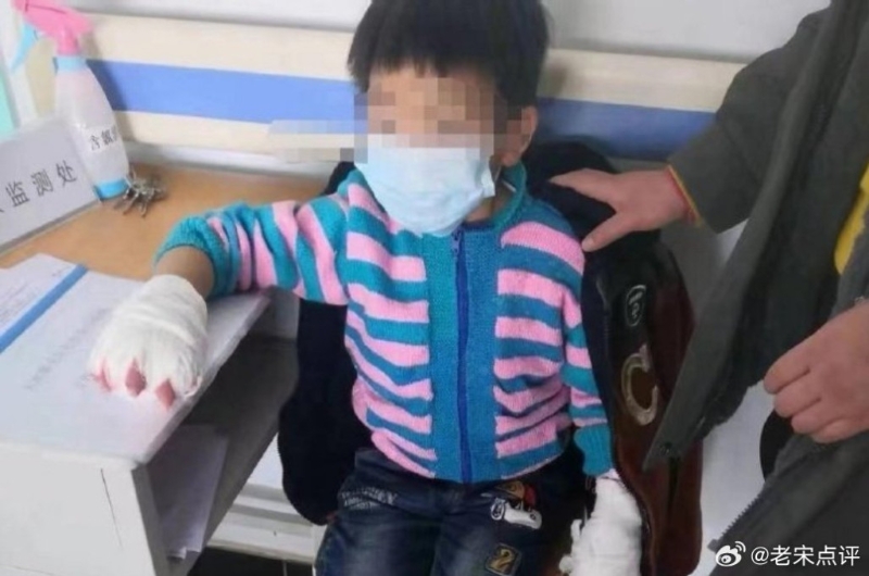 女孩惨遭虐待。 女孩惨遭虐待。