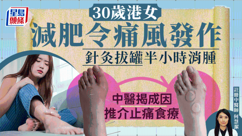 港女减肥引发痛风，中医治疗30分钟消肿，揭4方法预防痛风