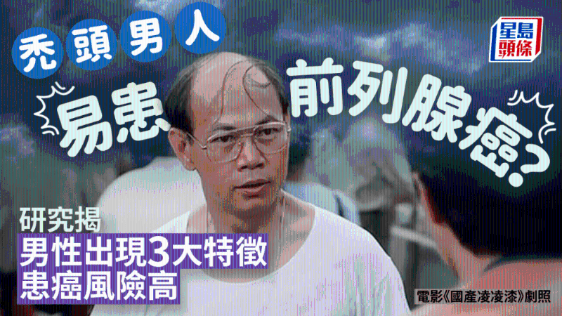 秃头男患前列腺癌风险高?研究揭男性出现3大特征恐患癌 秃头男患前列腺癌风险高?研究揭男性出现3大特征恐患癌