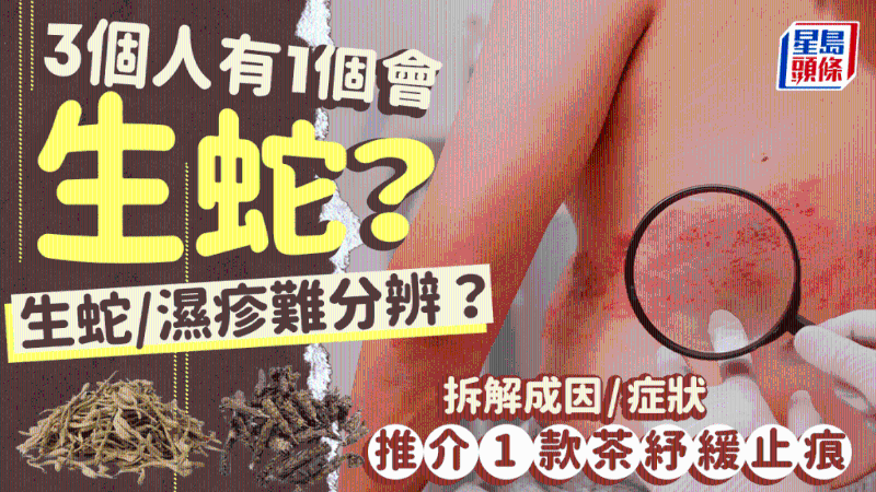 3人有1人会生蛇? 3人有1人会生蛇?