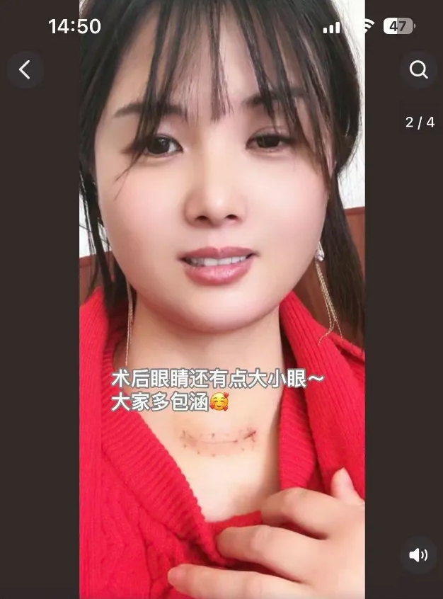 “一笑倾城”自曝患癌1 “一笑倾城”自曝患癌1