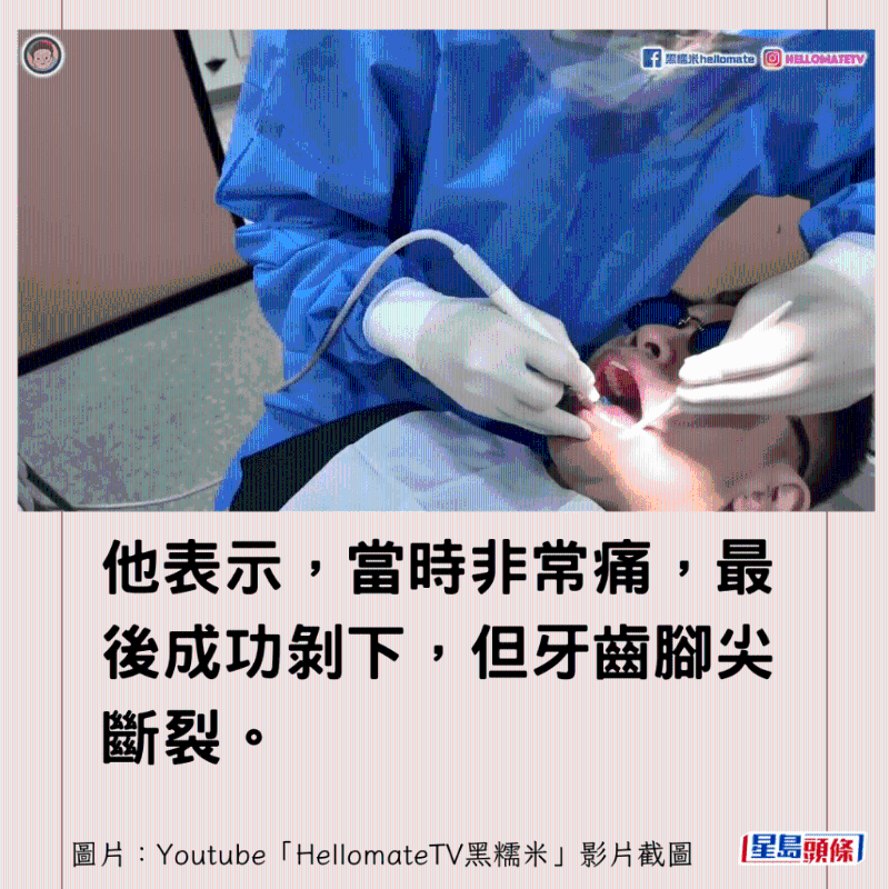 香港男子实测深圳平价洗牙种牙14