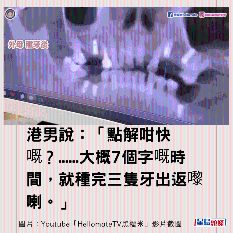 香港男子实测深圳平价洗牙种牙8