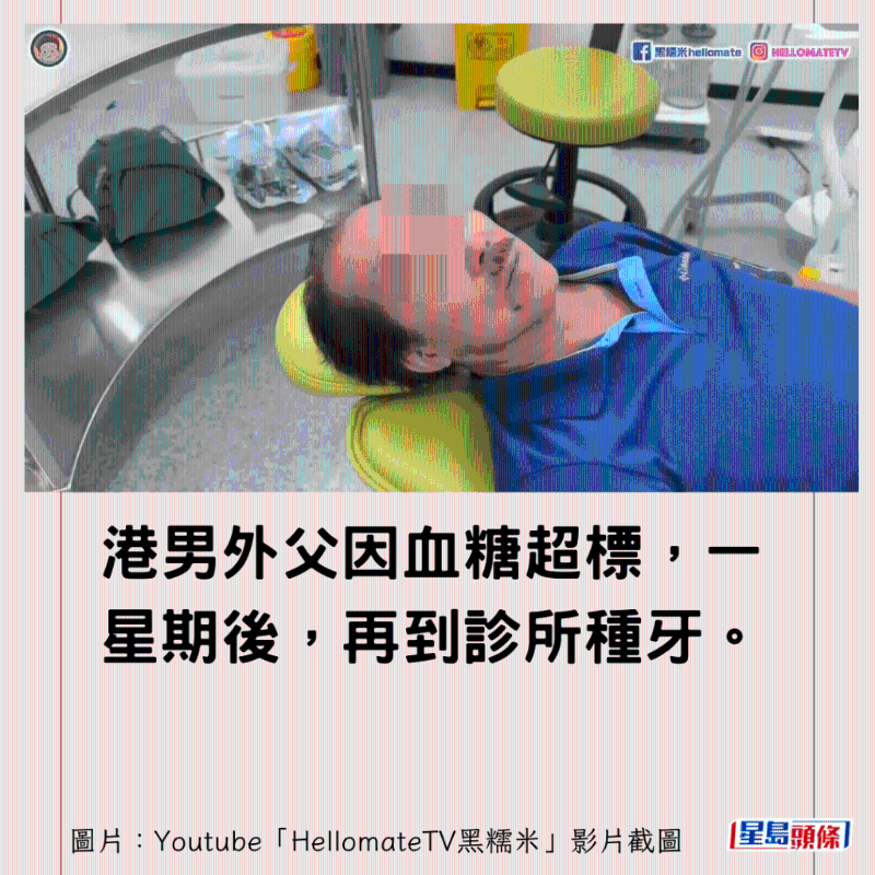 香港男子实测深圳平价洗牙种牙6