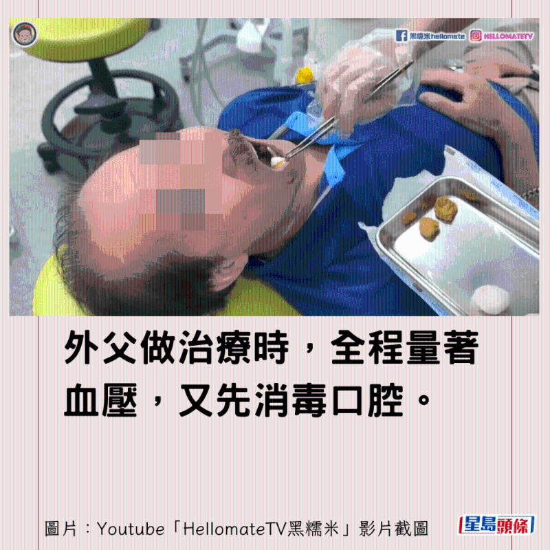 香港男子实测深圳平价洗牙种牙5