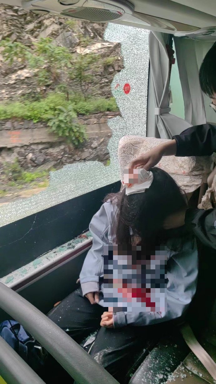 女乘客头部受伤。 女乘客头部受伤。