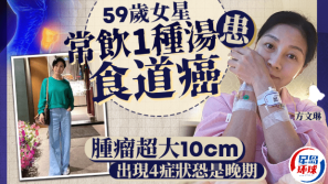 59岁女星常饮1种汤，患食道癌肿瘤10cm大，出现4症状恐属晚期