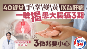 40岁女手掌变黄以为肝病，一验揭患大肠癌3期，3征兆要小心