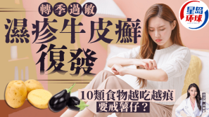 转季湿疹牛皮癣易复发，忌吃10类食物！薯仔越吃越痕？