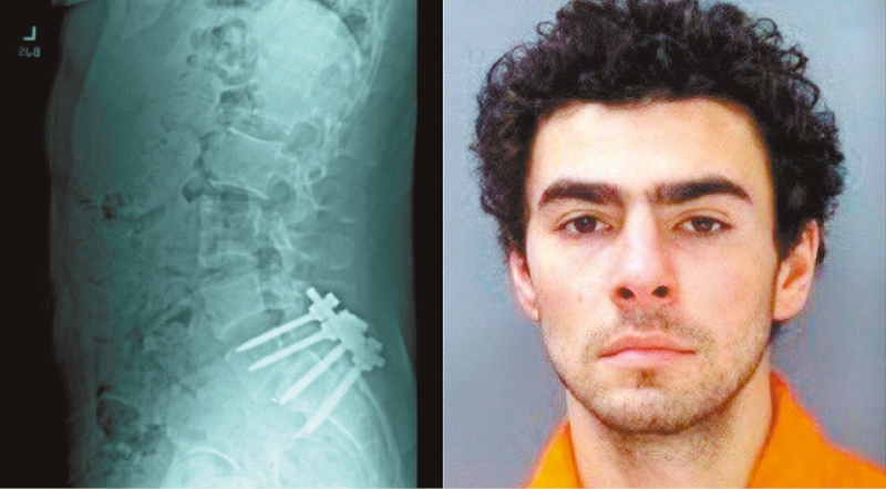 枪杀联合健保凶手。 枪杀联合健保凶手。