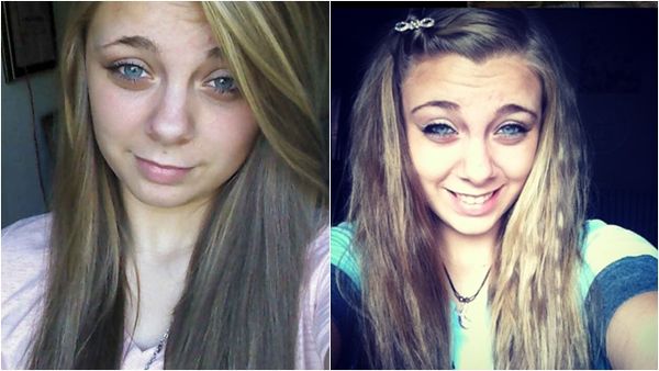 凯莉因注射大量冰毒,受幻觉影响自剜双目。 IG@kayleemuthart 凯莉因注射大量冰毒,受幻觉影响自剜双目。 IG@kayleemuthart