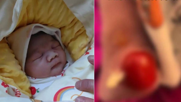 山东初生男婴洗澡时遭护士严重烫伤。影片截图 山东初生男婴洗澡时遭护士严重烫伤。影片截图