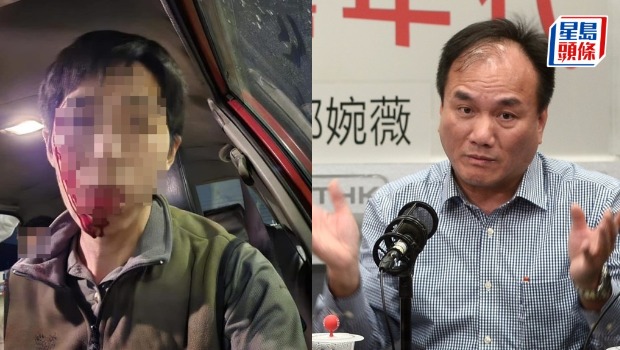 粉岭的士司机疑发晦气遭乘客殴伤 粉岭的士司机疑发晦气遭乘客殴伤