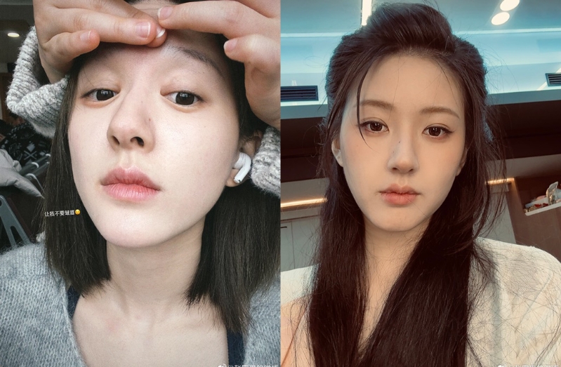 赵露思重病停工,健康状况引发各界关注。 赵露思重病停工,健康状况引发各界关注。