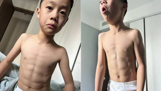 咳出8块腹肌 咳出8块腹肌