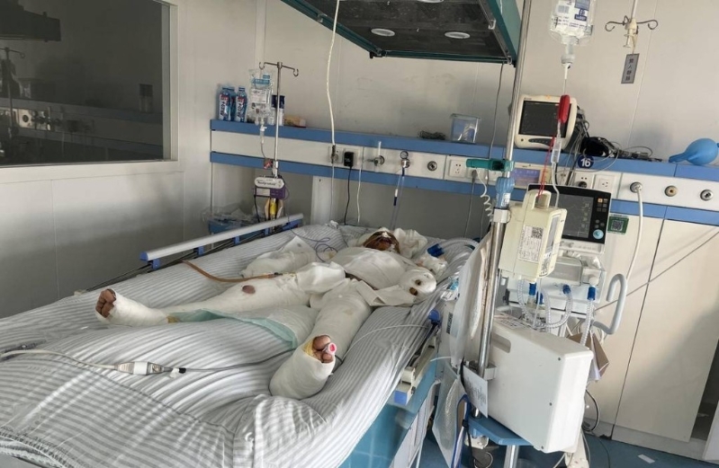 刘先生95%烧伤,浑身缠满纱布,随时面临生命危险。 紫牛新闻 刘先生95%烧伤,浑身缠满纱布,随时面临生命危险。 紫牛新闻