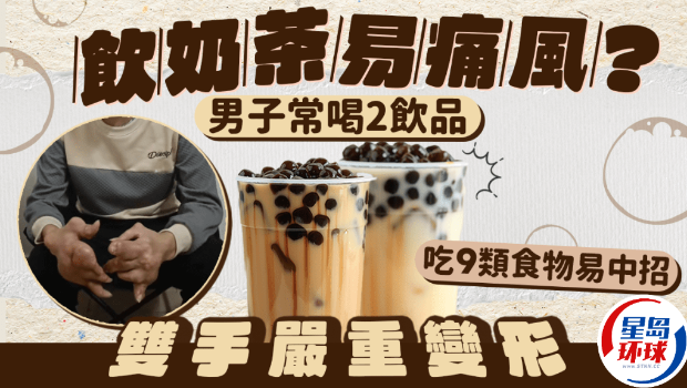 饮奶茶易痛风? 饮奶茶易痛风?