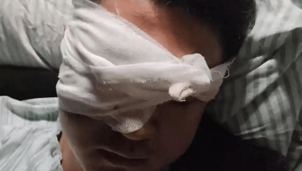 当街被烟花击中炸伤 当街被烟花击中炸伤