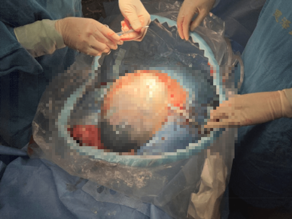 浙江一妈妈生出现实版哪吒 浙江一妈妈生出现实版哪吒