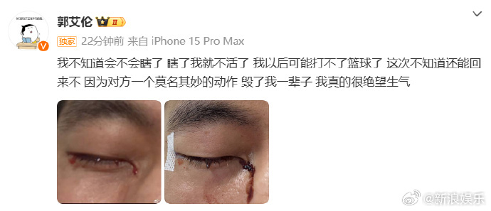 郭艾伦发出眼部受伤流血的照片。 郭艾伦发出眼部受伤流血的照片。