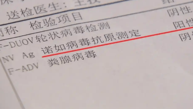 诺如病毒 诺如病毒