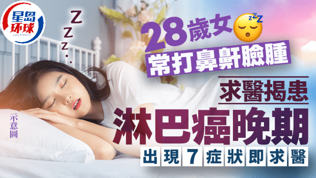28岁女常打鼻鼾脸肿 28岁女常打鼻鼾脸肿