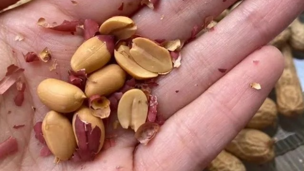 日食1公斤花生瓜子“顶瘾” 日食1公斤花生瓜子“顶瘾”