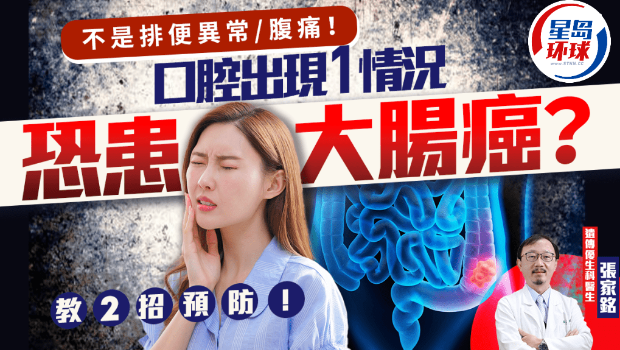 大肠癌前兆 大肠癌前兆