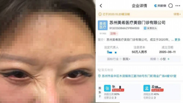 整容致10级伤残 整容致10级伤残