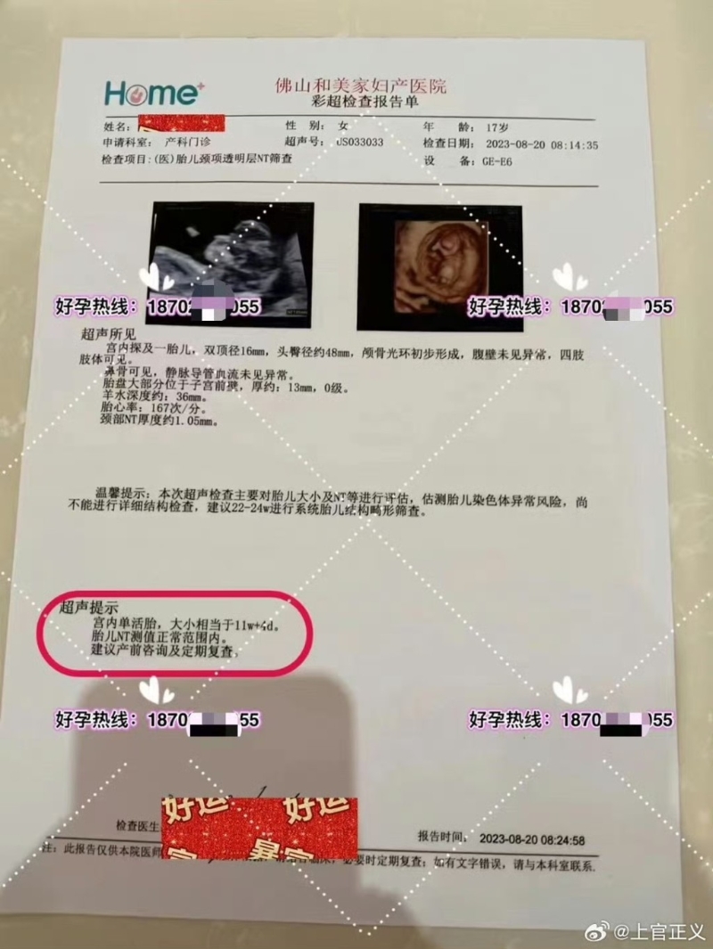 产检单。微博@上官正义 产检单。微博@上官正义