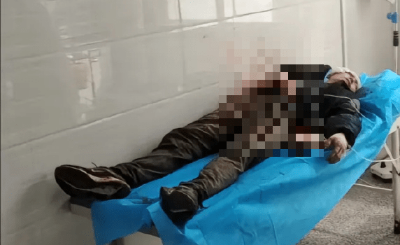 贵州男遭150公斤野猪袭击,头骨被咬破昏迷1周险送命。 贵州男遭150公斤野猪袭击,头骨被咬破昏迷1周险送命。