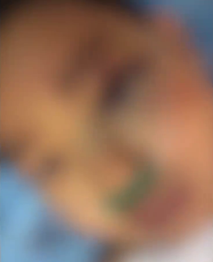 河北9岁女童25楼堕至7楼平台,奇迹生还。 河北9岁女童25楼堕至7楼平台,奇迹生还。