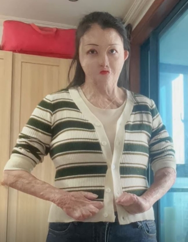 代婉月积极如常人般生活,追求自己的幸福。抖音@婉月 代婉月积极如常人般生活,追求自己的幸福。抖音@婉月