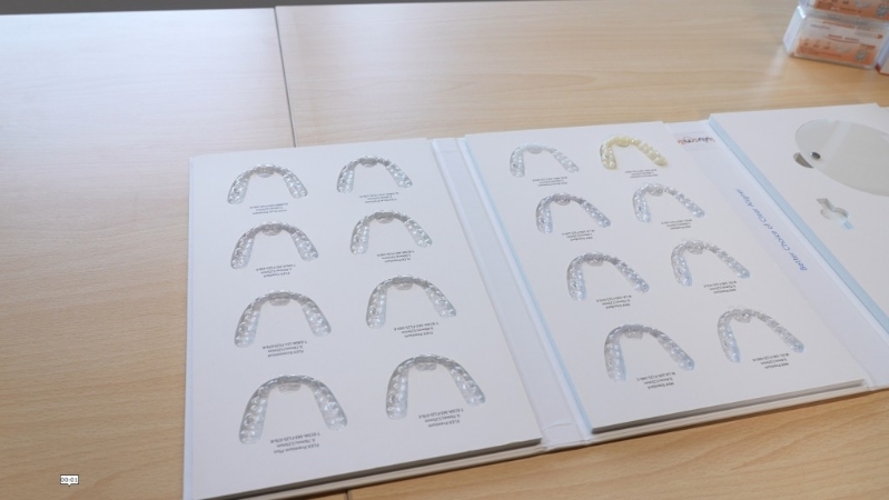 除透明牙套之外,lulusmiles还准备有偏白或更贴近真实牙齿颜色的牙套,以更符合病人需求。 除透明牙套之外,lulusmiles还准备有偏白或更贴近真实牙齿颜色的牙套,以更符合病人需求。