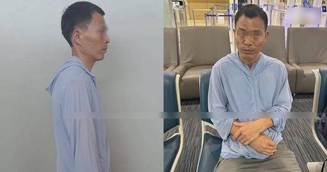 疑凶面部有伤痕。 暹罗飞鸟 疑凶面部有伤痕。 暹罗飞鸟