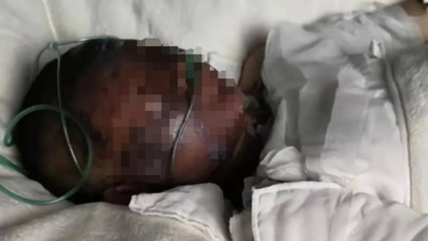 8岁女童开灯突然爆炸 8岁女童开灯突然爆炸