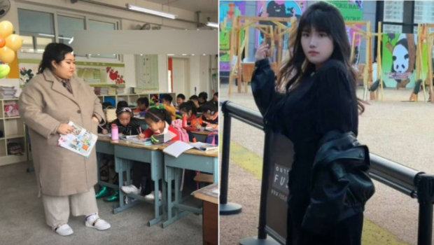 黄女士以每两个月13公斤的速度,将体重减半至目前85公斤。 黄女士以每两个月13公斤的速度,将体重减半至目前85公斤。