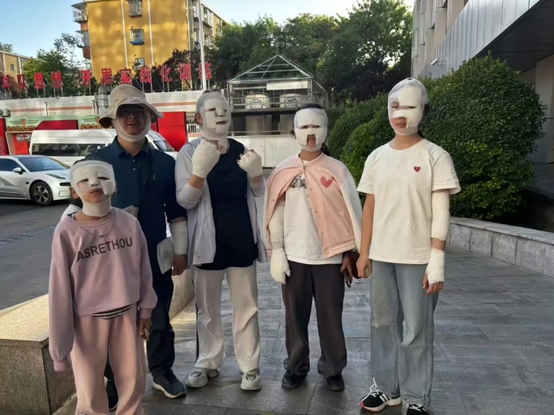 野外烧烤遇卡式炉爆炸多人被炸伤 野外烧烤遇卡式炉爆炸多人被炸伤