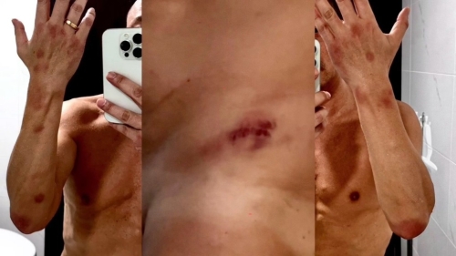 王喜全身满布血痕。 王喜全身满布血痕。