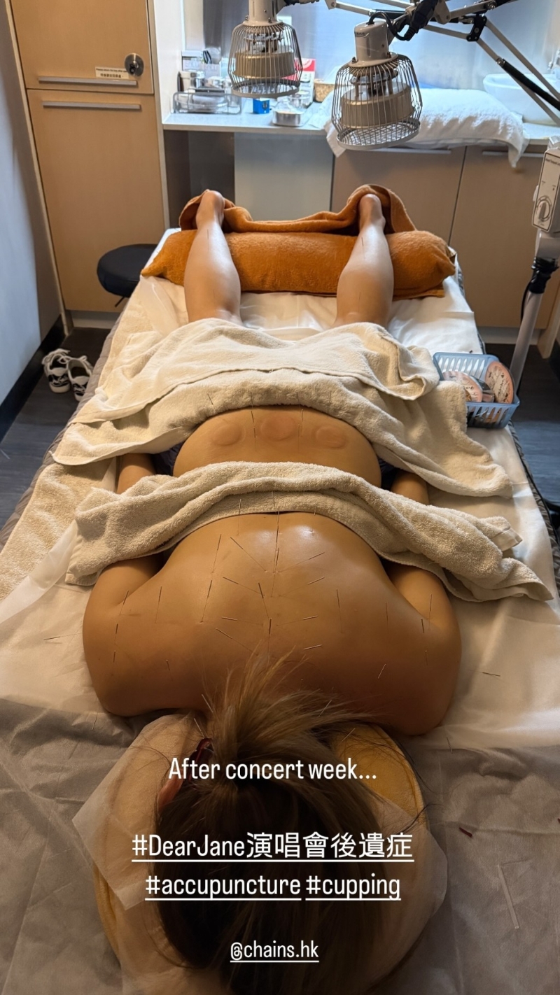 杨洛婷到医疗中心针炙和拔罐,画面触目惊心。 杨洛婷到医疗中心针炙和拔罐,画面触目惊心。