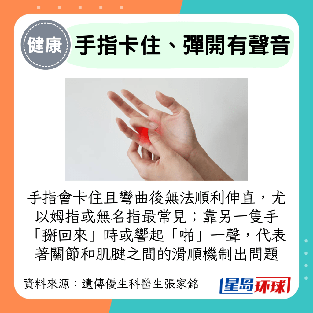 手指会卡住且弯曲后无法顺利伸直,尤以姆指或无名指最常见; 靠另一只手“掰回来”时或响起“啪”一声,代表着关节和肌腱之间的滑顺机制出问题 手指会卡住且弯曲后无法顺利伸直,尤以姆指或无名指最常见; 靠另一只手“掰回来”时或响起“啪”一声,代表着关节和肌腱之间的滑顺机制出问题