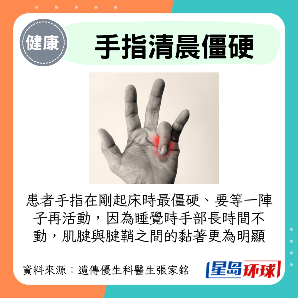 患者手指在刚起床时最僵硬、要等一阵子再活动,因为睡觉时手部长时间不动,肌腱与腱鞘之间的黏着更为明显 患者手指在刚起床时最僵硬、要等一阵子再活动,因为睡觉时手部长时间不动,肌腱与腱鞘之间的黏着更为明显