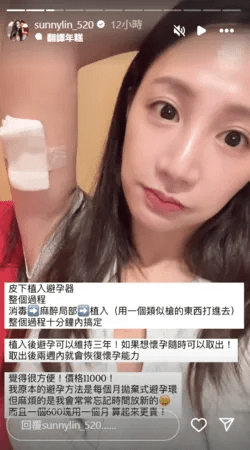 林采缇指自己做了皮下植入避孕器。 林采缇指自己做了皮下植入避孕器。