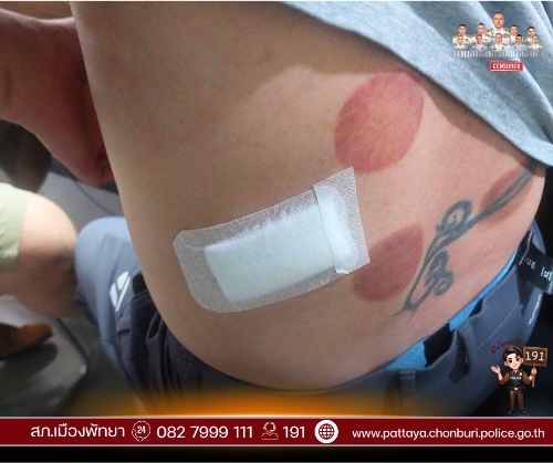 受害人伤势。 受害人伤势。