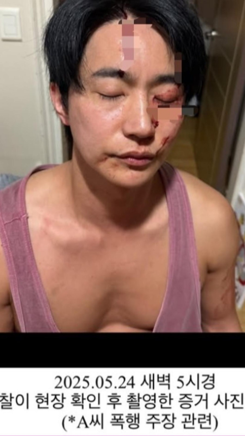 全浩俊晒出鼻青脸肿的照片回应。 (TVBS新闻网图片) 全浩俊晒出鼻青脸肿的照片回应。 (TVBS新闻网图片)