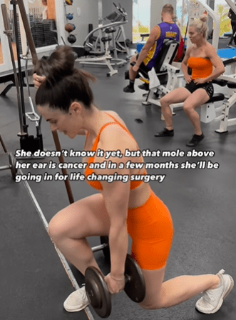 医生为她进行手术时警告,这个位置靠近主要神经相当危险,可能导致左脸完全失去知觉。 医生为她进行手术时警告,这个位置靠近主要神经相当危险,可能导致左脸完全失去知觉。